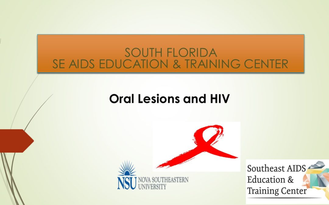 Webinar: HIV and Oral Health – Oral Lesions and HIV