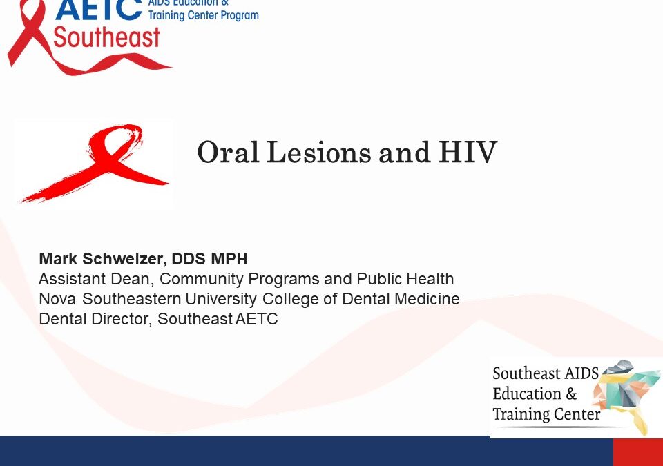Webinar: Oral Lesions and HIV